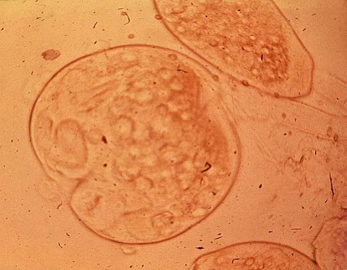 Ký sinh trùng đơn bào Costia là trùng roi có kích thước siêu nhỏ