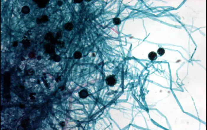 Hình ảnh nấm thủy mi dưới kính hiển vi