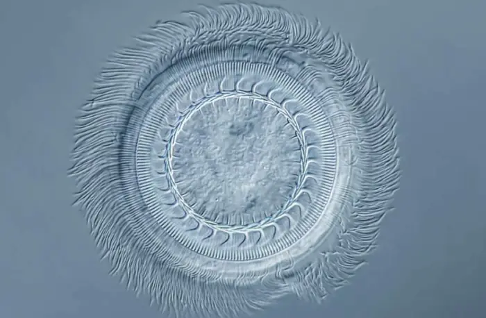 Trichodina có hình tròn với hàng trăm móc nhỏ di chuyển cắm vào cơ thể cá Koi