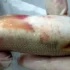 Hướng dẫn cách trị bệnh ký sinh trùng đơn bào đốm trắng White Spot (Ich) ở cá Koi